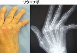 手の痛み しびれ ささくら整形と手のクリニック